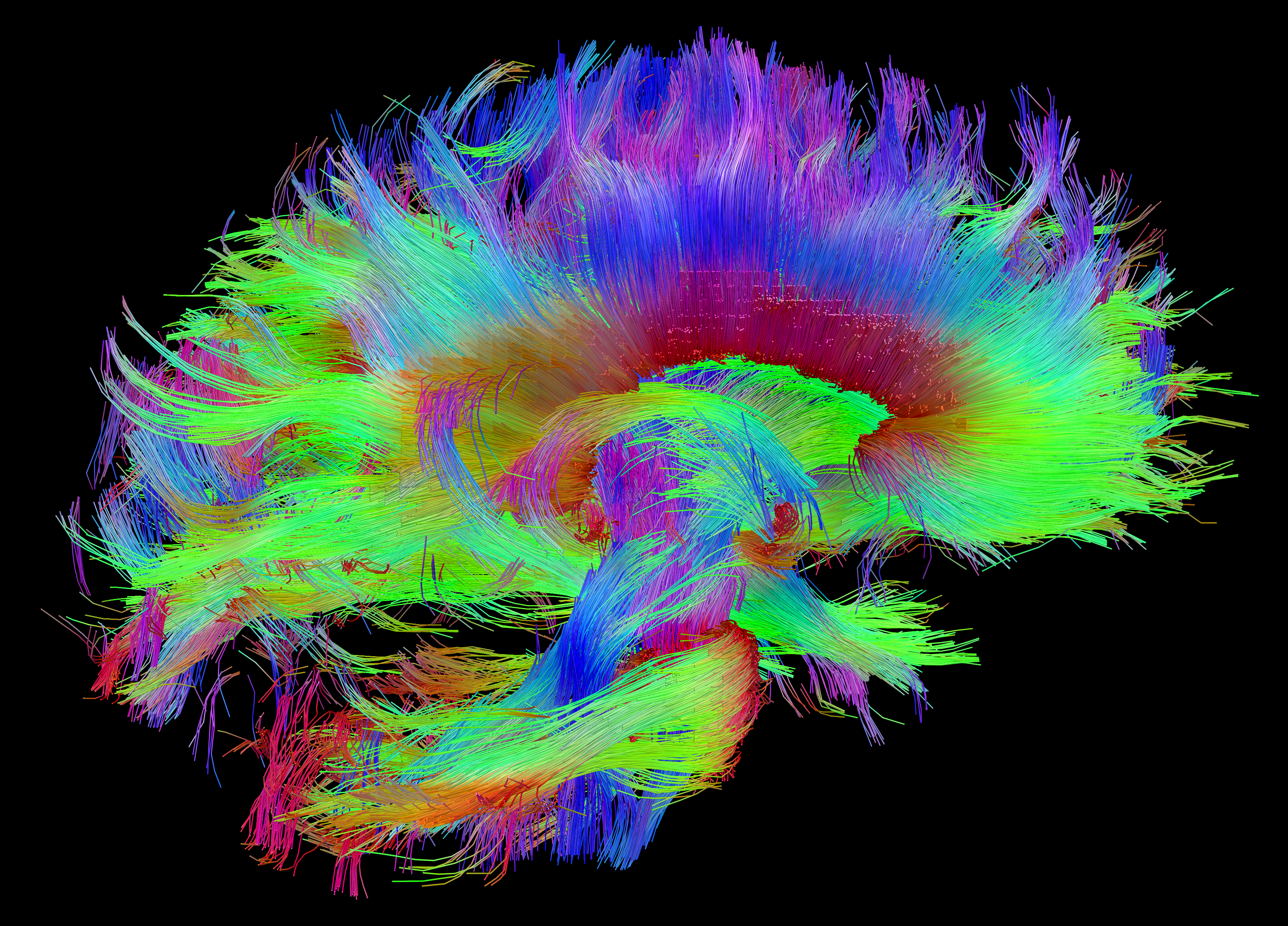 white-matter-fibers-hcp-dataset-red-corpus-callosum