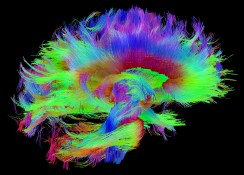 white-matter-fibers-hcp-dataset-red-corpus-callosum